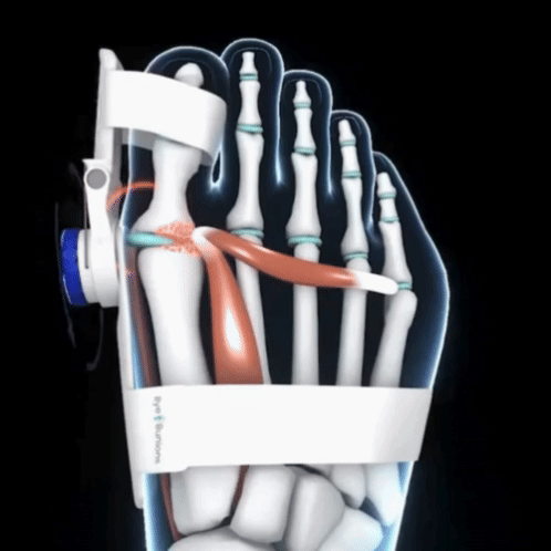 🔥 🦶 Corrige Tu Juanete Sin Cirugía y Sin Dolor Desde Hoy + Envío gratis — Lleva la 2° unidad con 50% de descuento