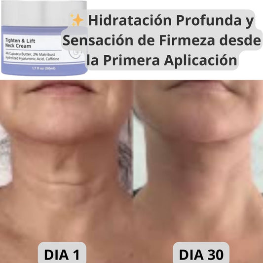 Tighten & Lift Neck Cream: Reafirma tu cuello y luce más joven desde hoy + ENVÍO GRATIS 🚚