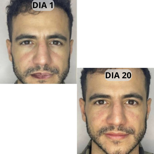 ⚡ La fórmula diseñada para mejorar la apariencia de tus labios + Envío gratis